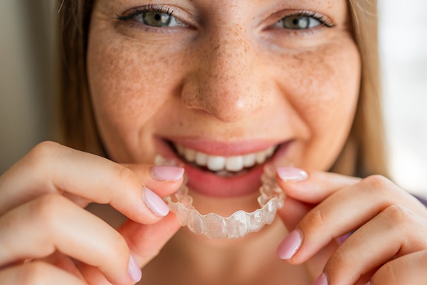 When To Choose Clear Braces Over Traditional Braces