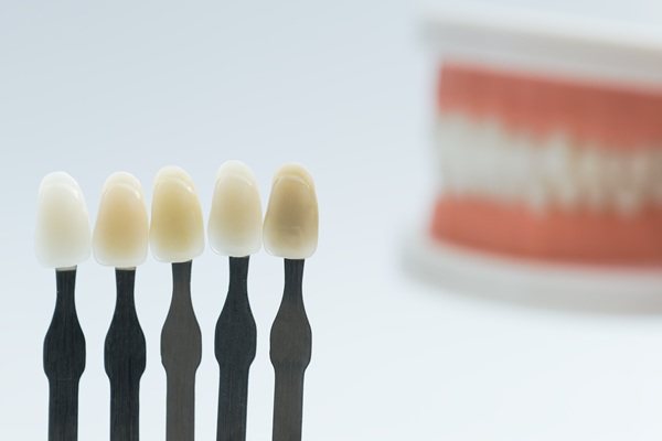 Understanding Dental Bonding: A Simple Smile Restoration Blueprint