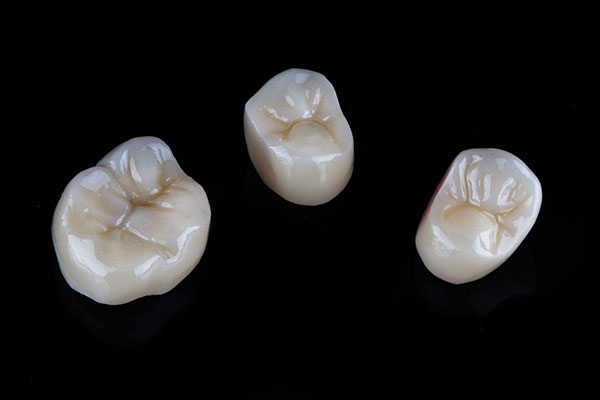 A Comparison of Dental Crown Materials from Sonoran Desert Dentistry in Scottsdale, AZ
