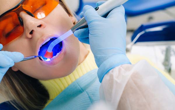 Dental Fillings: Restoring Teeth Affected By Cavities And Decay