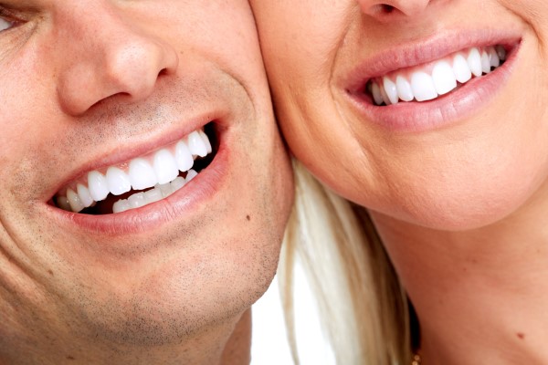 Smile Makeover With Dental Veneers