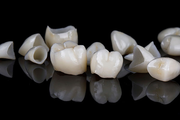What Are the Differences Between a Dental Crown and a Dental Veneer? from Sonoran Desert Dentistry in Scottsdale, AZ