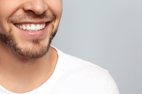 Full Mouth Reconstruction: A Step By Step Guide To Restoring Your Smile