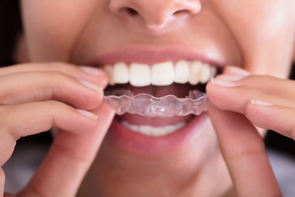 How A Night Guard Can Protect Teeth