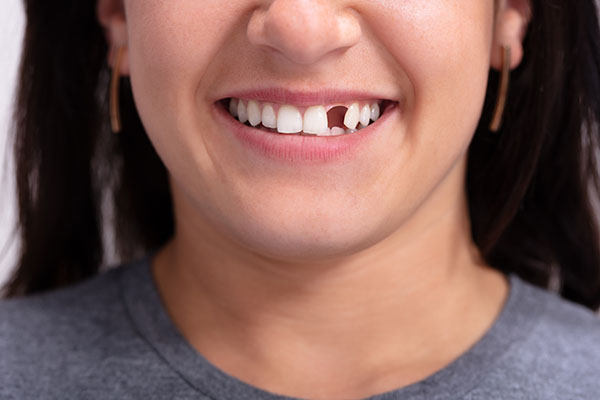 Options for Replacing Missing Teeth With Cosmetic Dental Services from Sonoran Desert Dentistry in Scottsdale, AZ