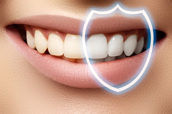 Three Tips To Prepare For A KöR Teeth Whitening Procedure