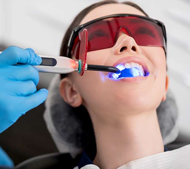 Scottsdale Professional Teeth Whitening