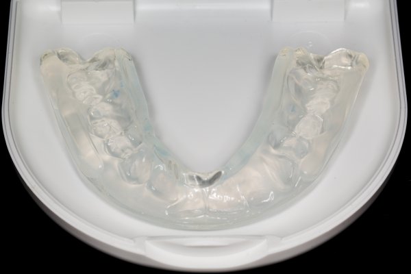Reasons To Choose Invisalign To Straighten Your Smile