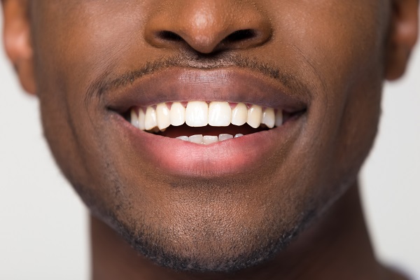 Three Ways Teeth Straightening Improves Your Oral Health - Sonoran