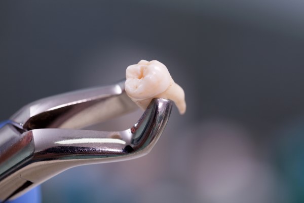 Potential Issues When You Do Not Have Wisdom Teeth Removed